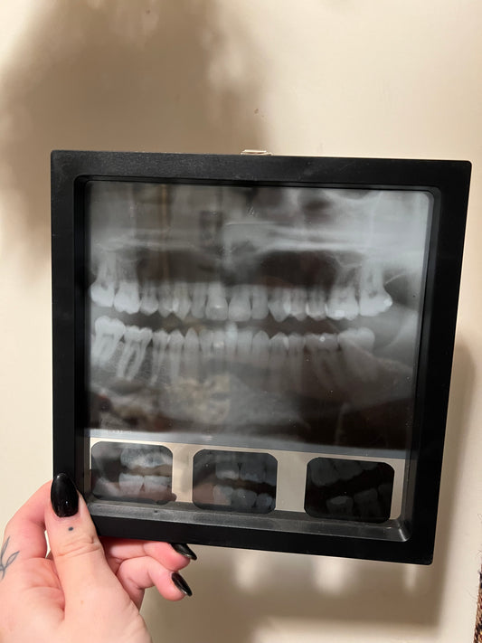 Dental Xray Displays